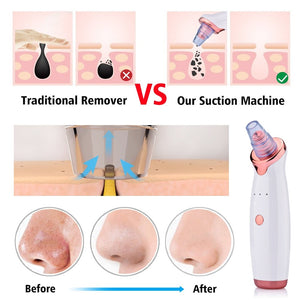 The Microdermabrasion Tool
